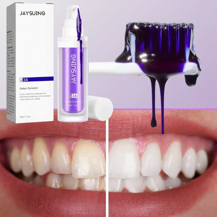 Blanqueador dental V34 | Blanquea tus dientes al instante